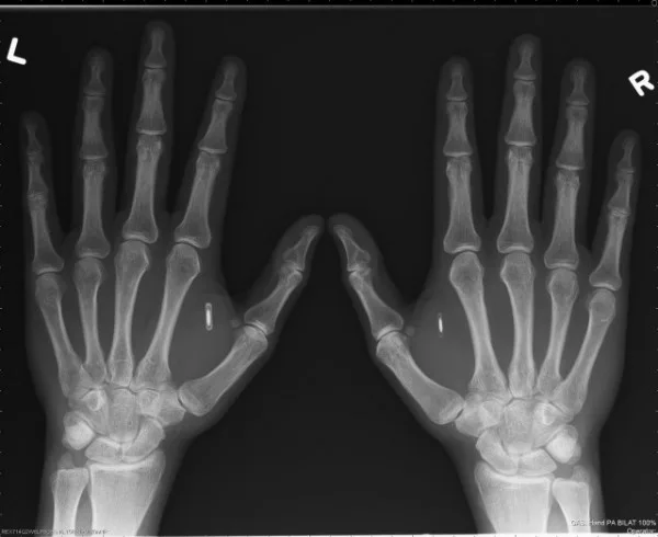 Bitcoin Hands
