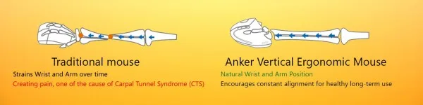 anker-wireless-vertical-ergonomic-mouse-bone