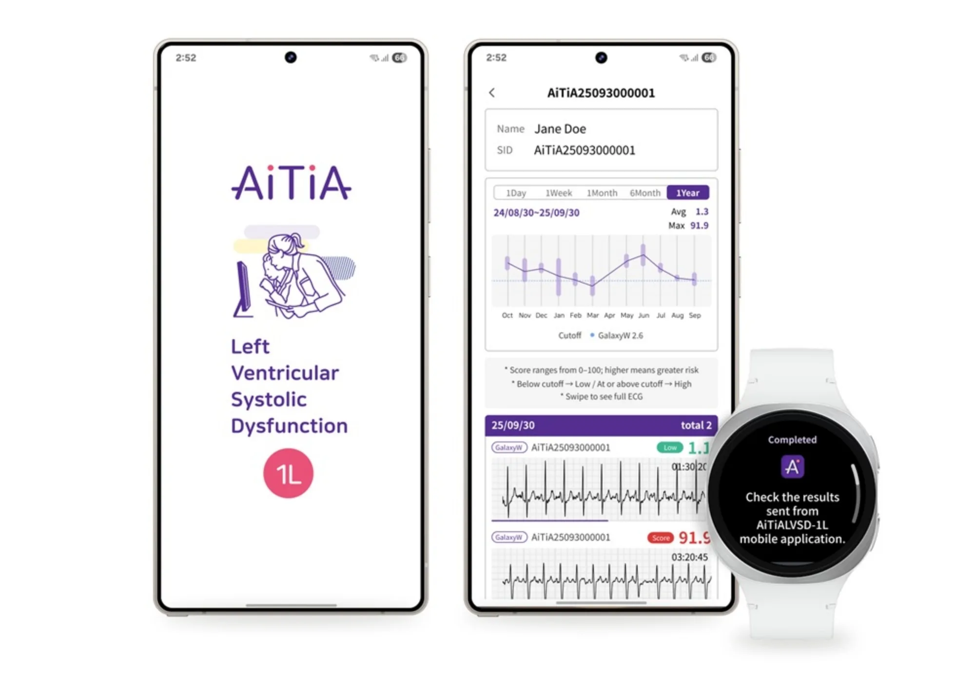 Samsung Galaxy Watch LVSD detection